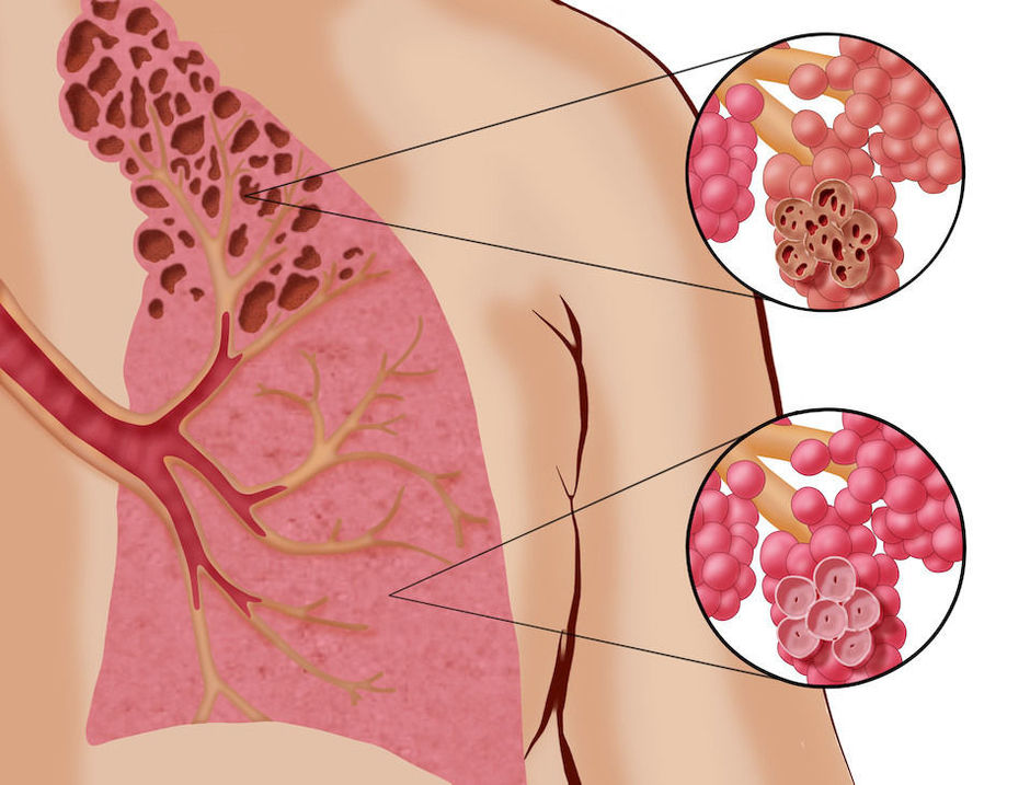 Area Terapeutica